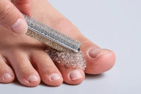 Roka ki pili kurje oko ilustracija za kako se znebiti kurjih očes