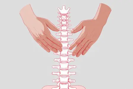 Terapevtske roke ki pomagajo pri umiku hernije diska ponazarjajo kako pozdraviti hernijo diska brez operacije