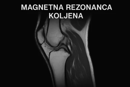 kako izgleda magnetna resonanca kolena kako izgleda magnetna resonanca kolena